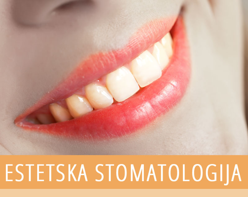 estetska stomatologija beograd