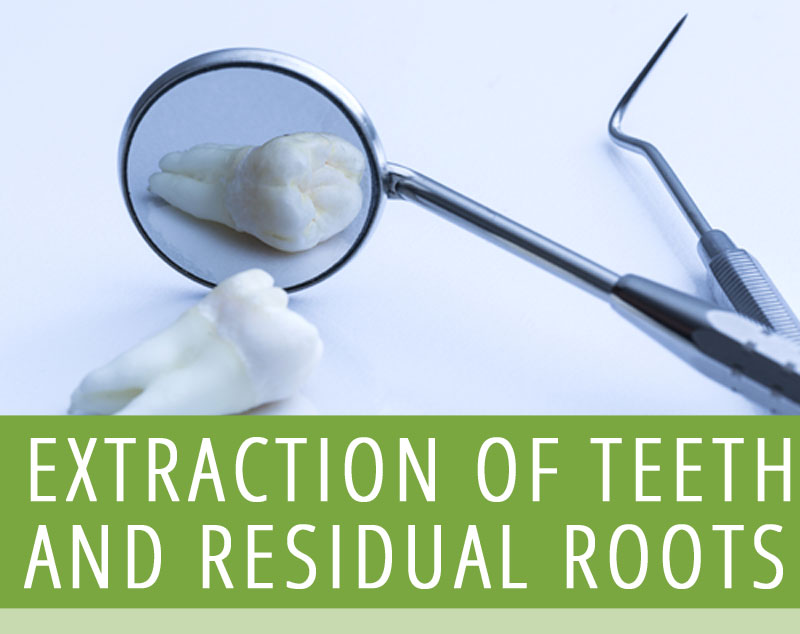 Extraction of Teeth and Residual Roots